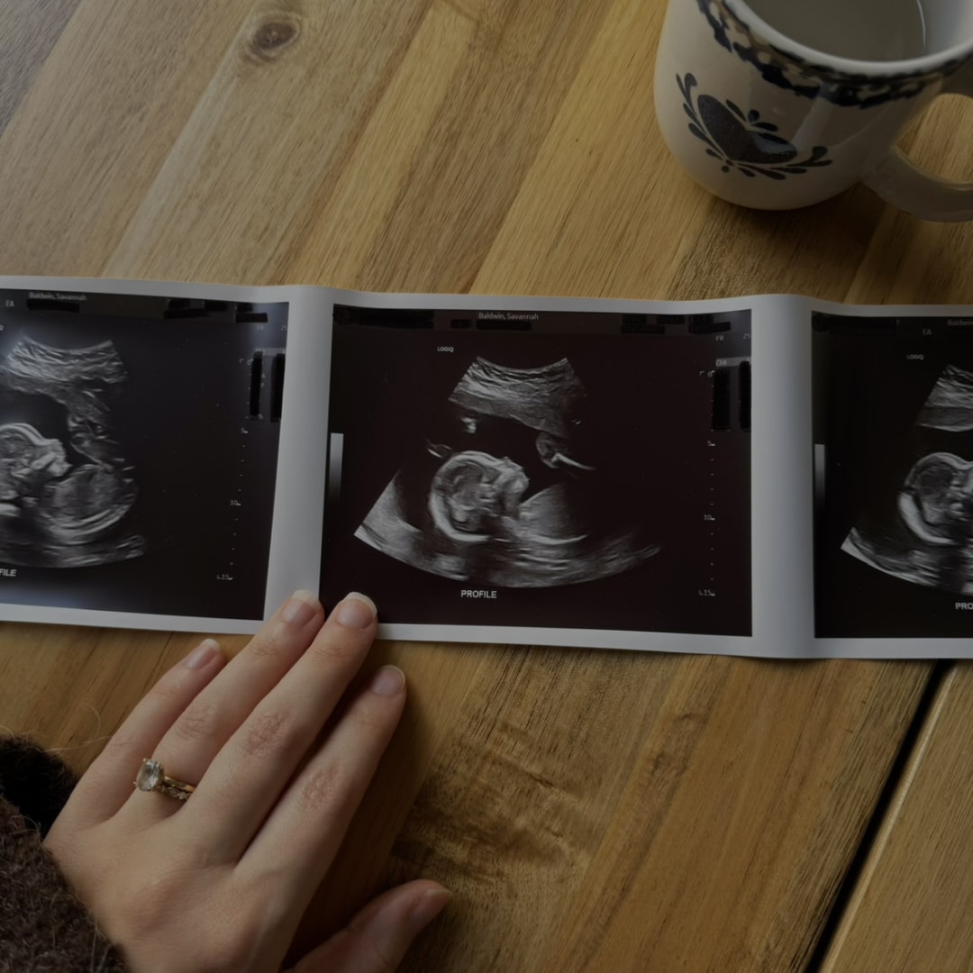 Photo shared by Savannah for their Babylist baby registry.