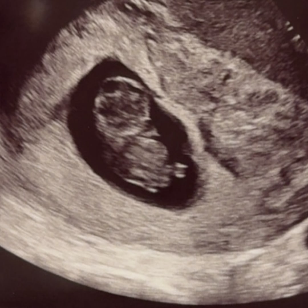 Photo shared by Emillie for their Babylist baby registry.