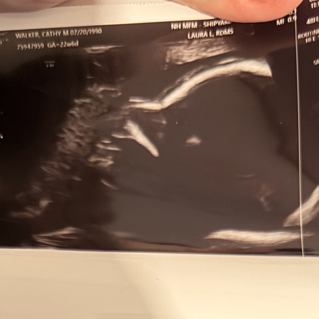 Photo shared by Morgan for their Babylist baby registry.