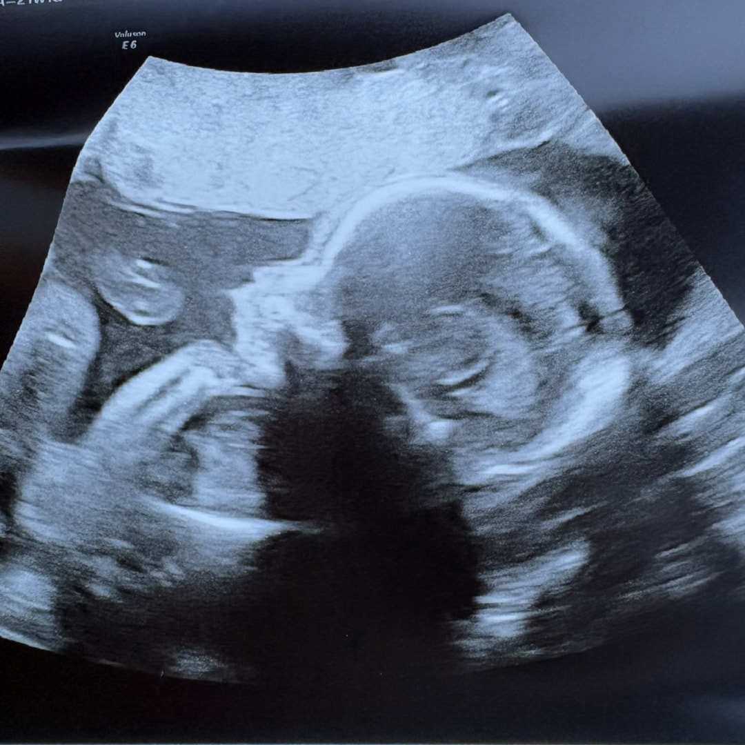 Photo shared by Corey for their Babylist baby registry.