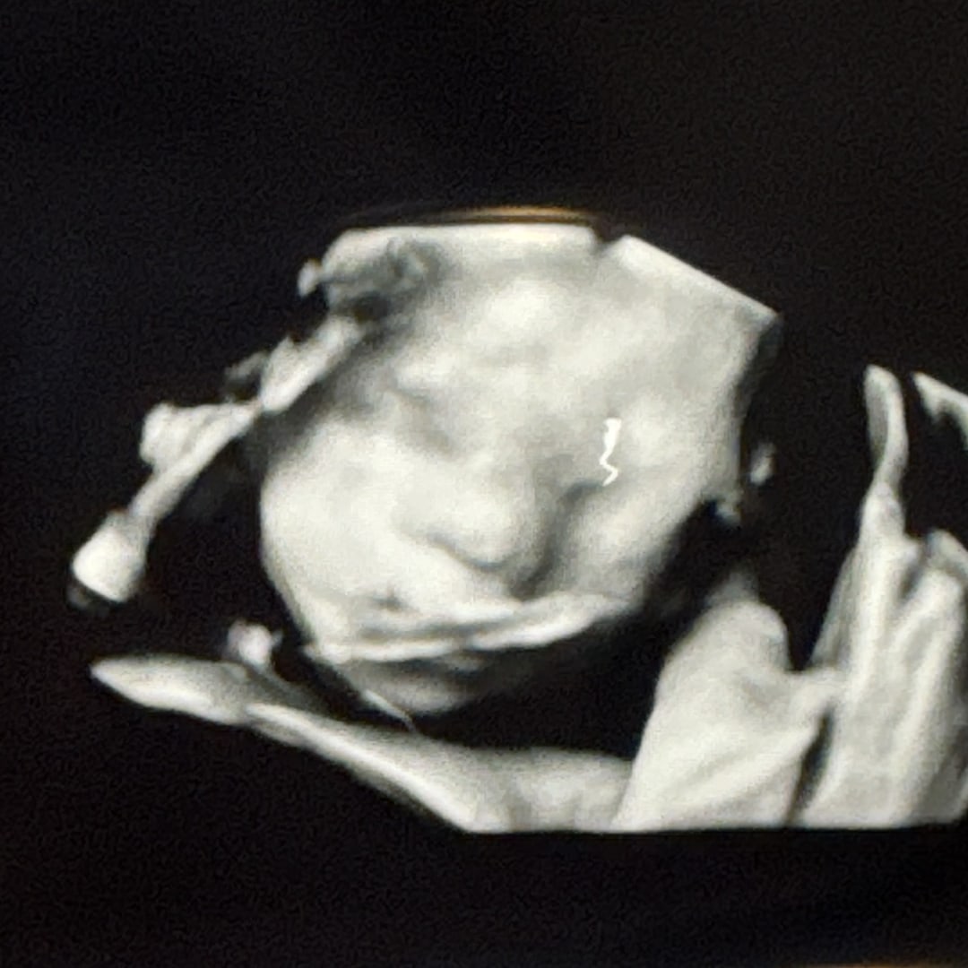 Photo shared by Leslie for their Babylist baby registry.