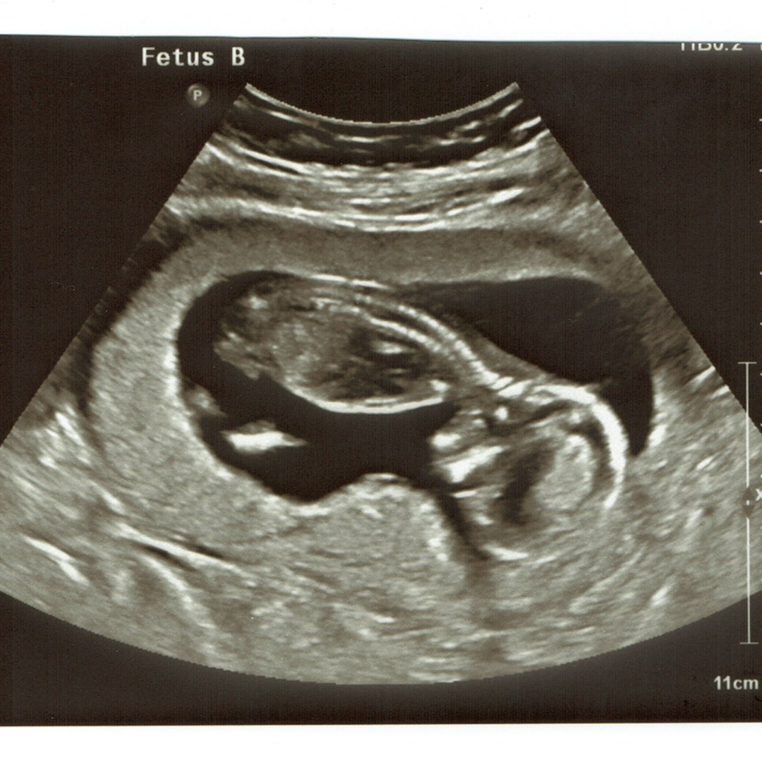 Photo shared by Patrick for their Babylist baby registry.