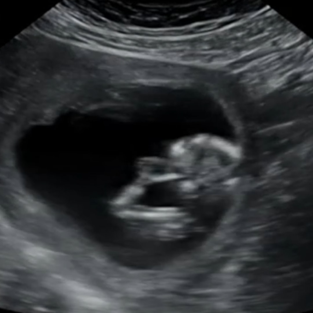 Photo shared by Sheyanne for their Babylist baby registry.