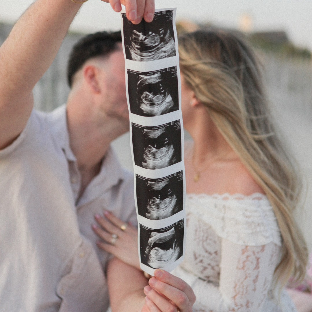 Photo shared by Elizabeth for their Babylist baby registry.