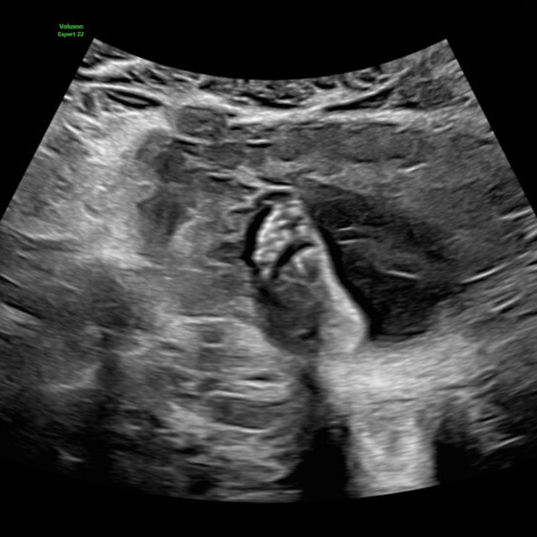 Photo shared by Marlene for their Babylist baby registry.