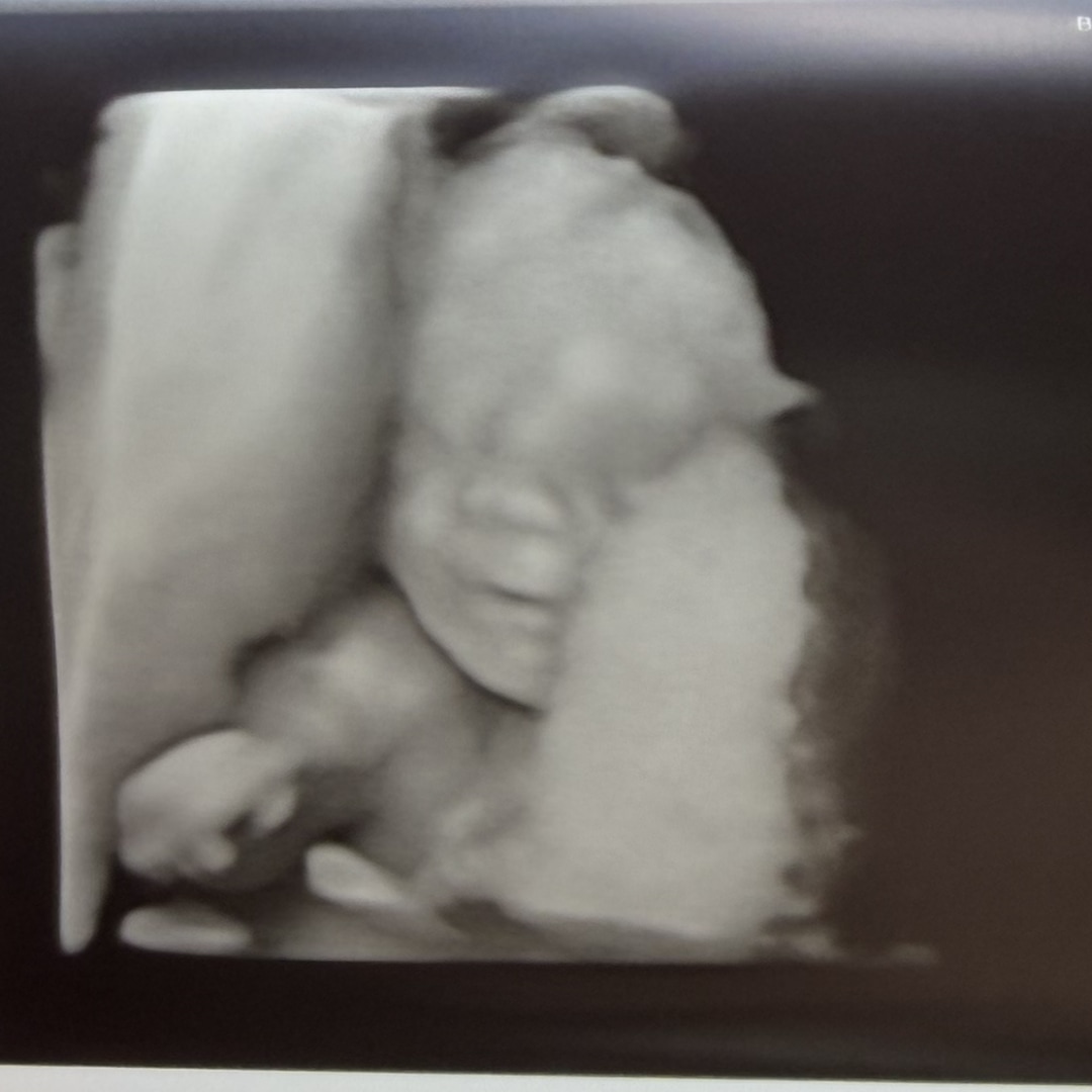 Photo shared by Landrie for their Babylist baby registry.