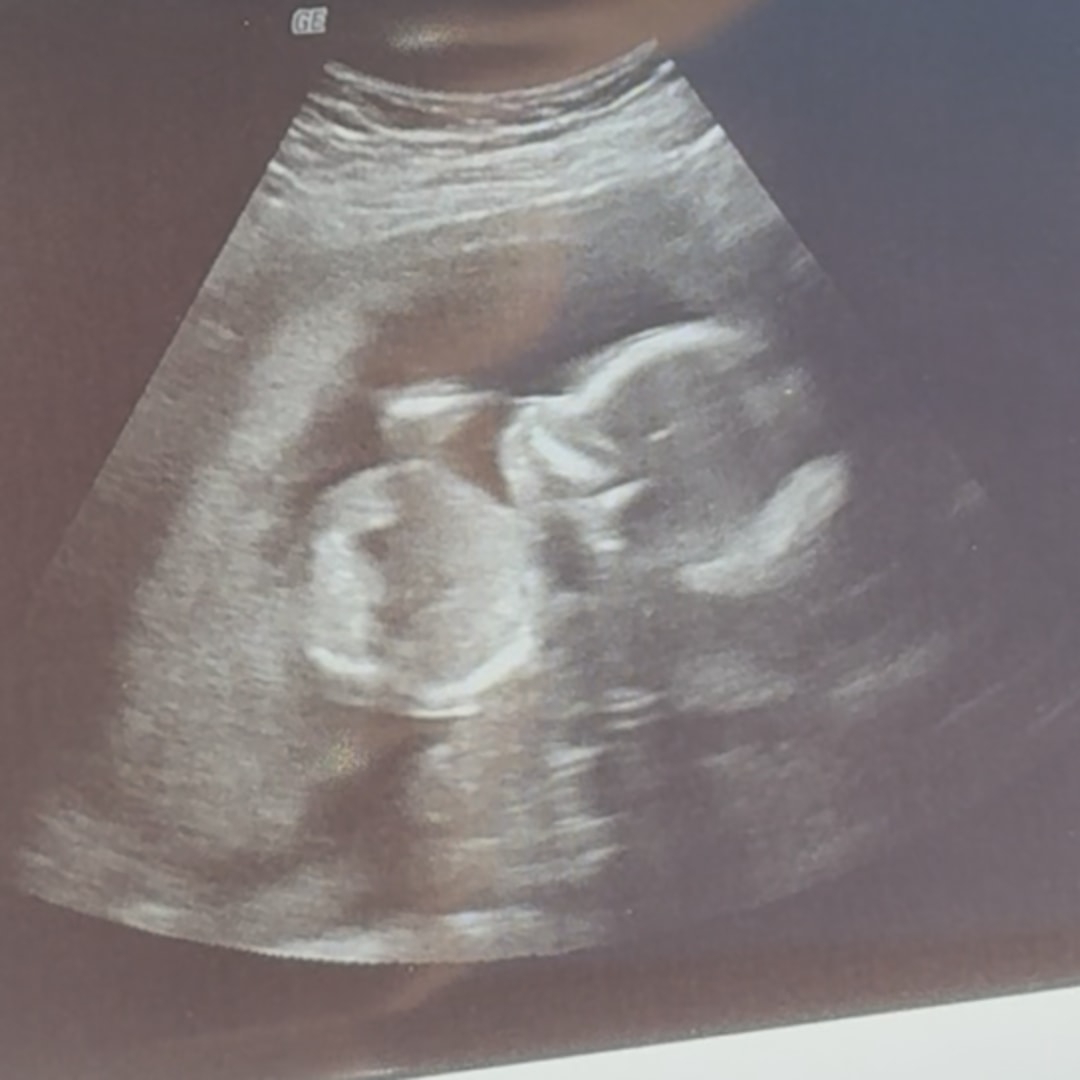 Photo shared by Ali for their Babylist baby registry.