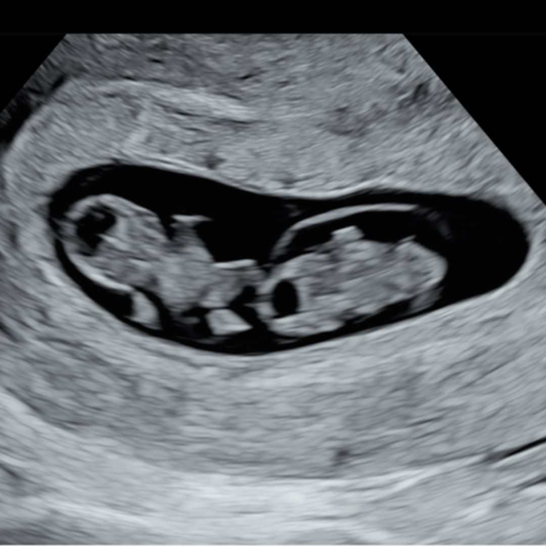Photo shared by Veronica for their Babylist baby registry.