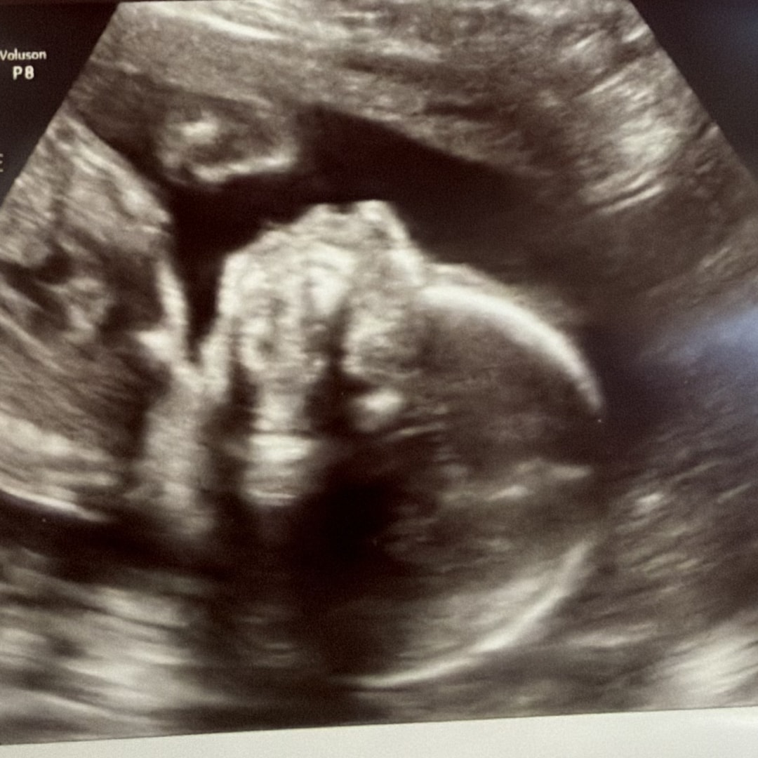 Photo shared by Julia for their Babylist baby registry.