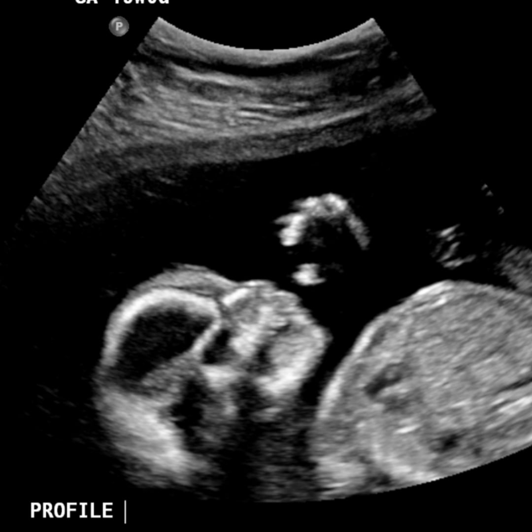 Photo shared by Ellie for their Babylist baby registry.