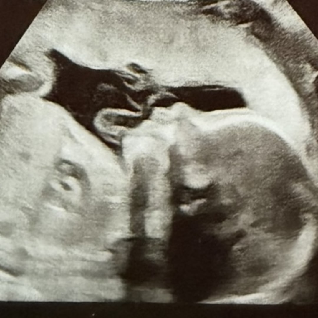 Photo shared by Caitlin for their Babylist baby registry.