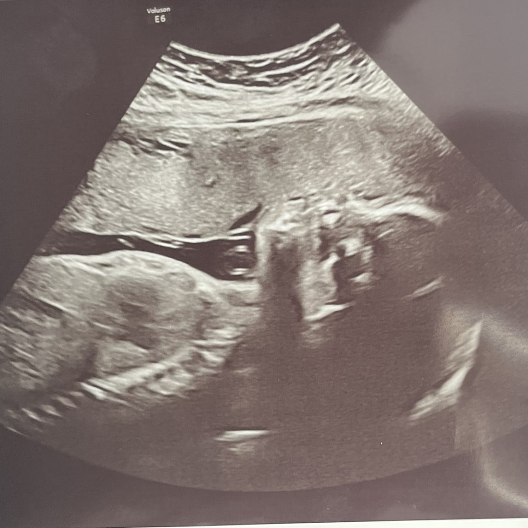 Photo shared by Bella for their Babylist baby registry.