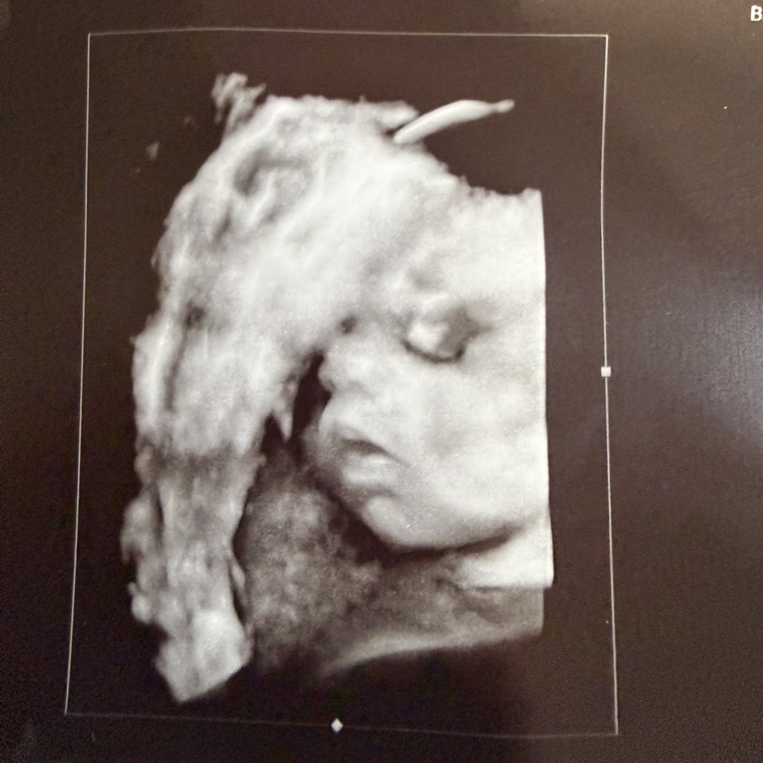 Photo shared by Destiny for their Babylist baby registry.