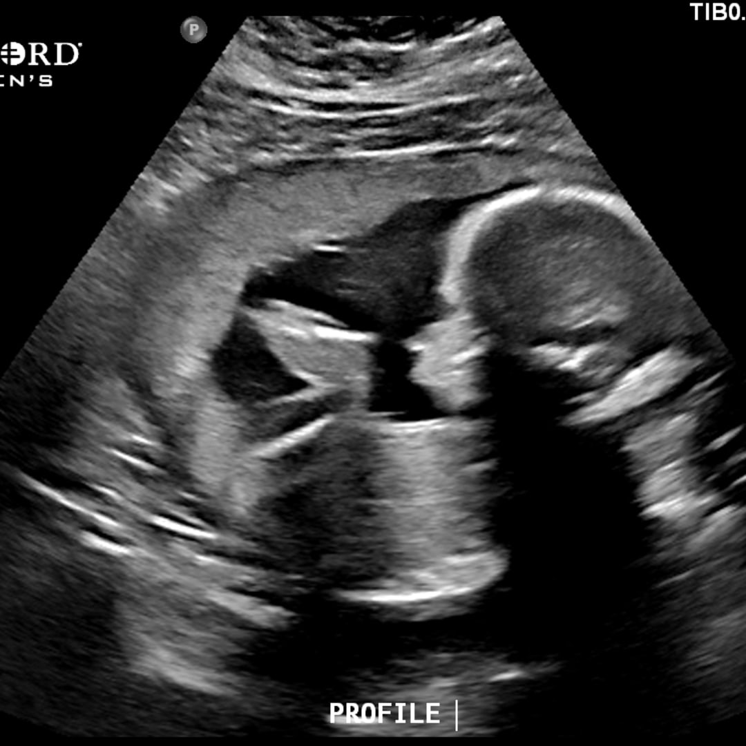 Photo shared by Cora for their Babylist baby registry.