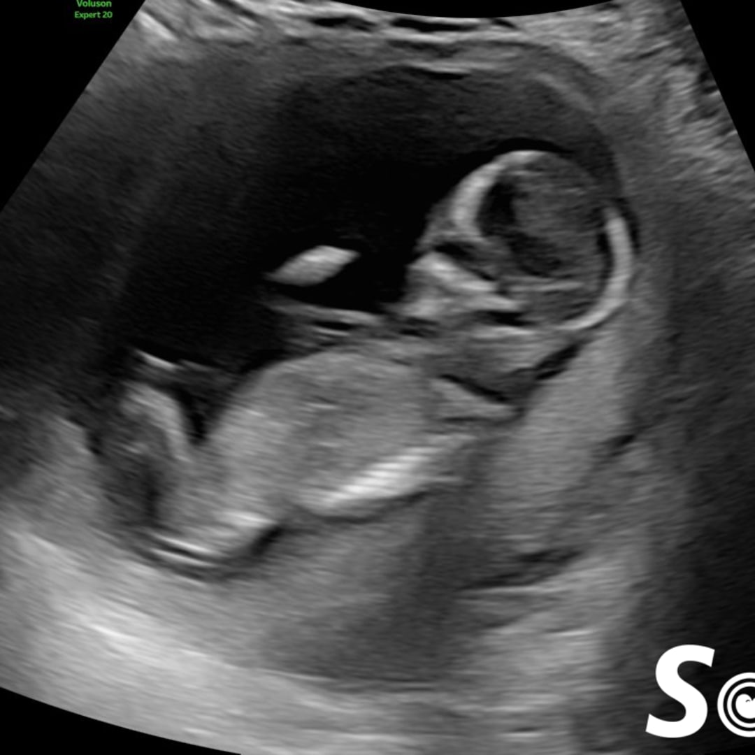 Photo shared by Jaydan for their Babylist baby registry.