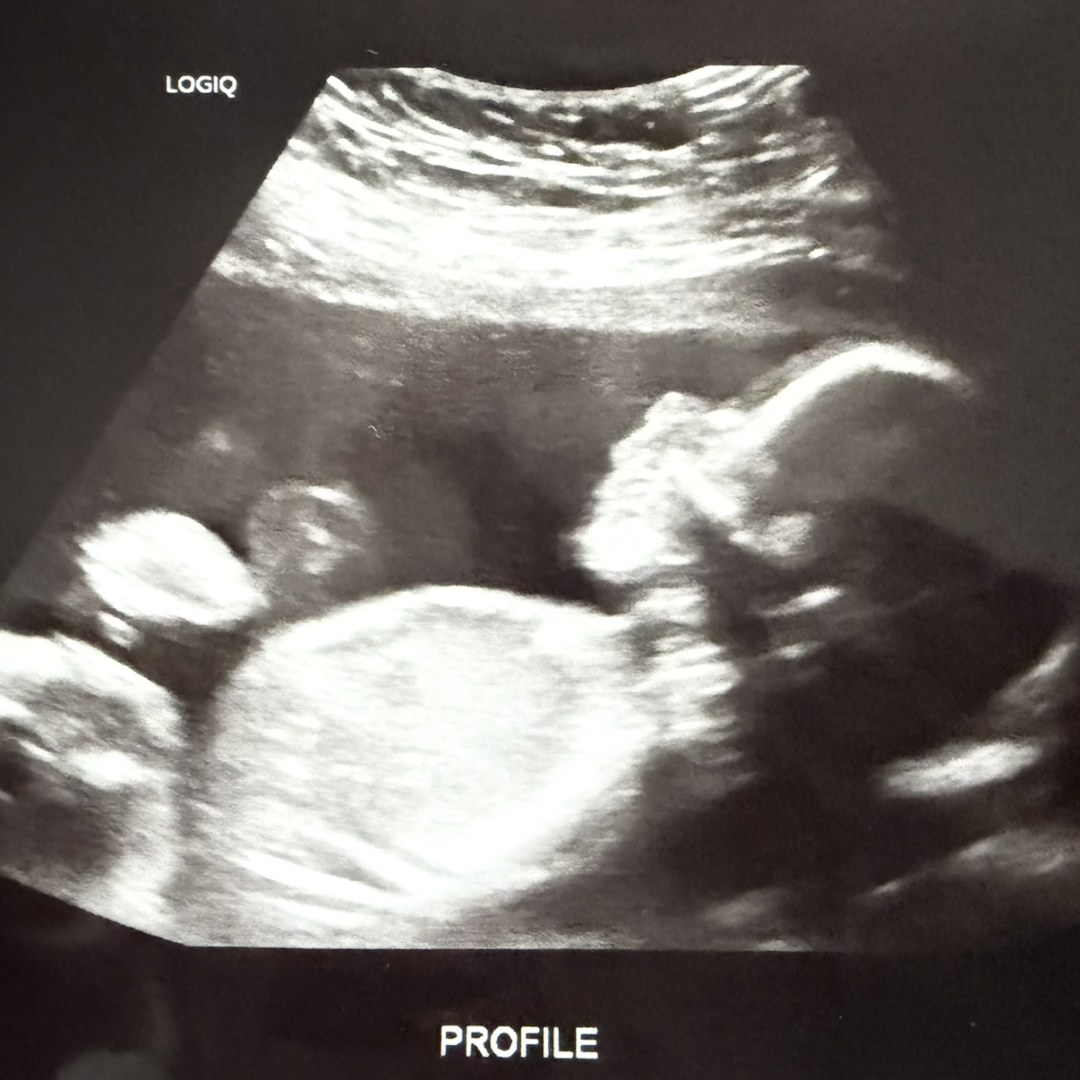 Photo shared by Lauren for their Babylist baby registry.