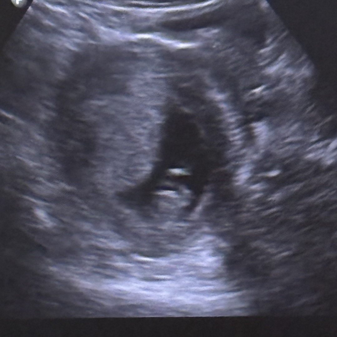 Photo shared by Danielle for their Babylist baby registry.