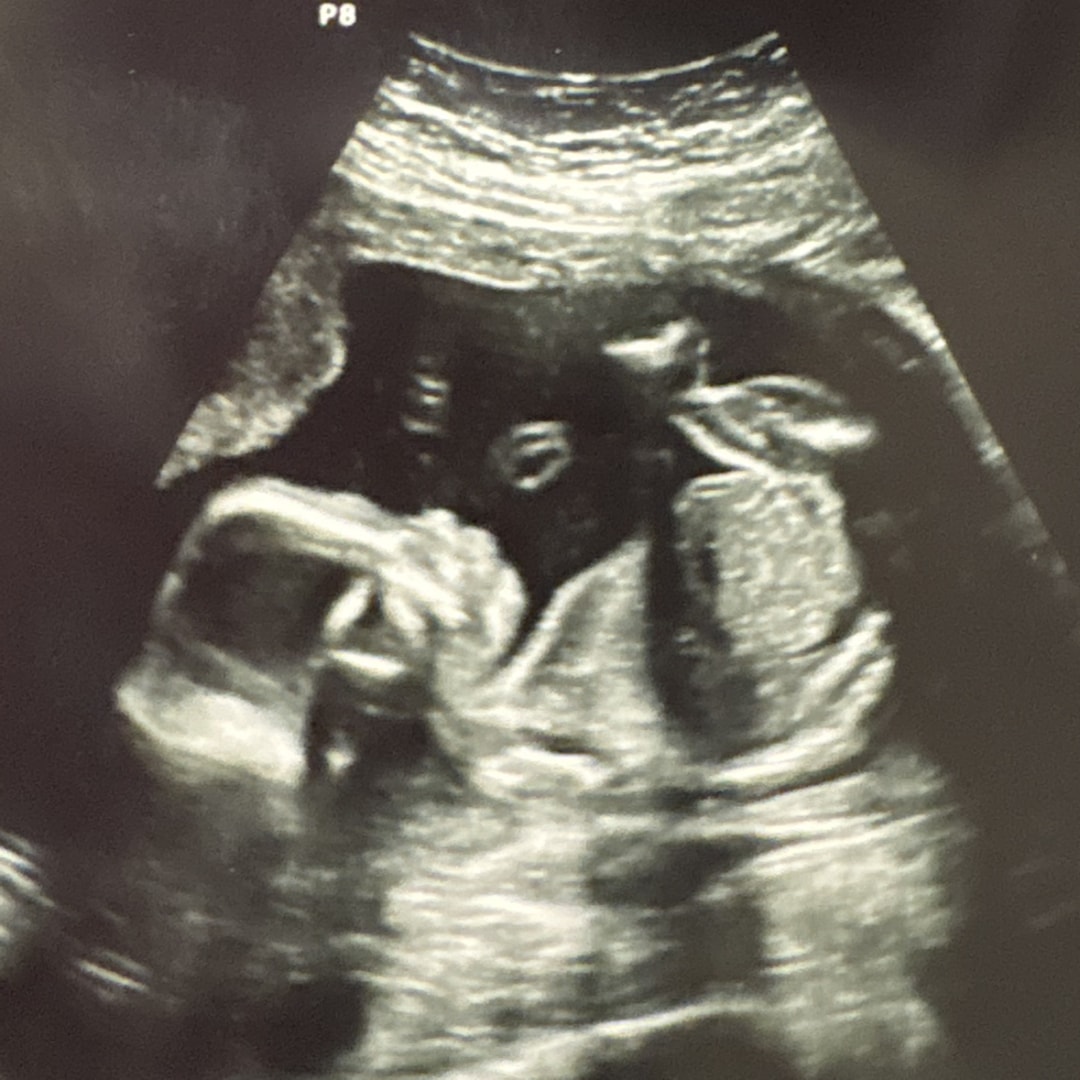 Photo shared by Breeanna for their Babylist baby registry.