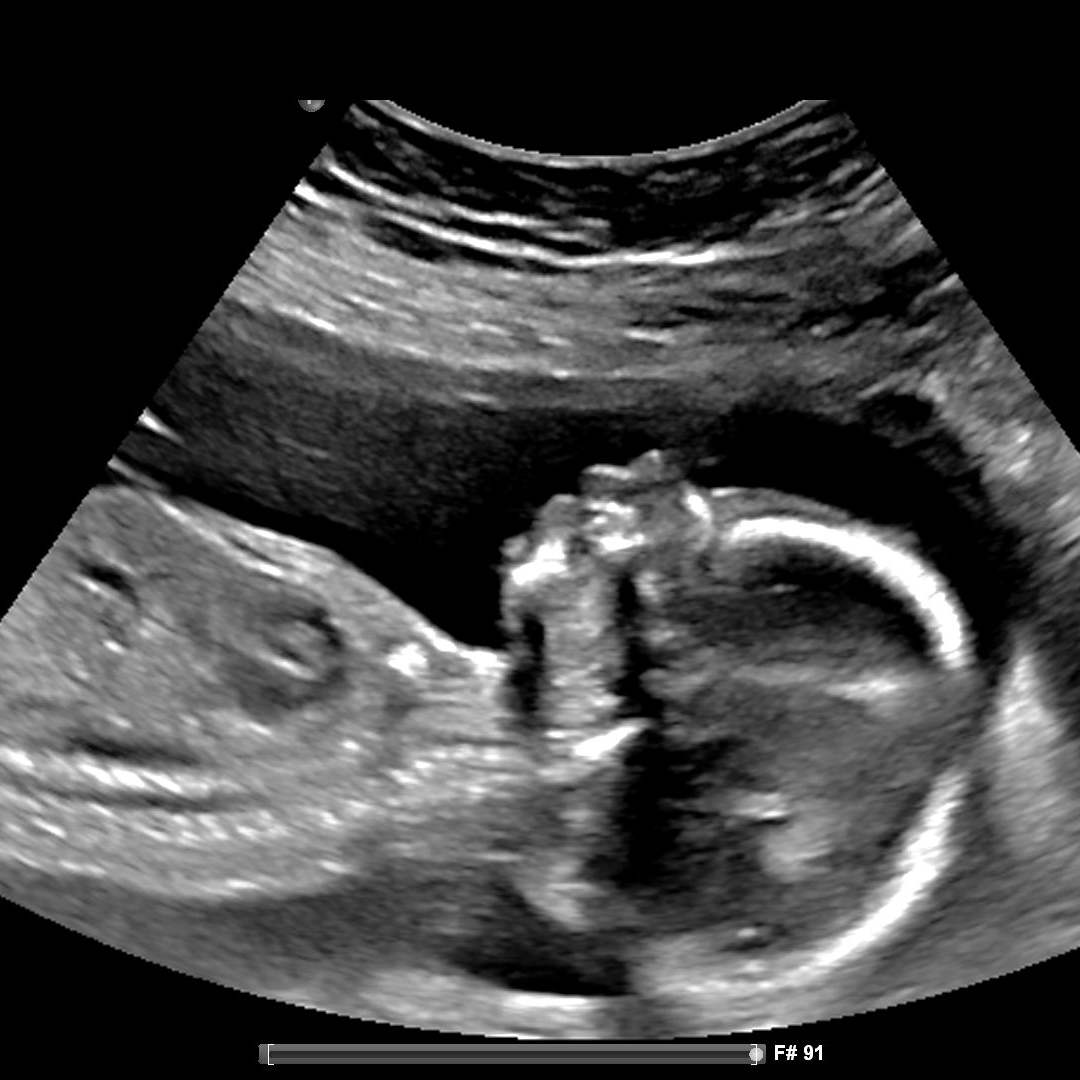 Photo shared by Simone for their Babylist baby registry.