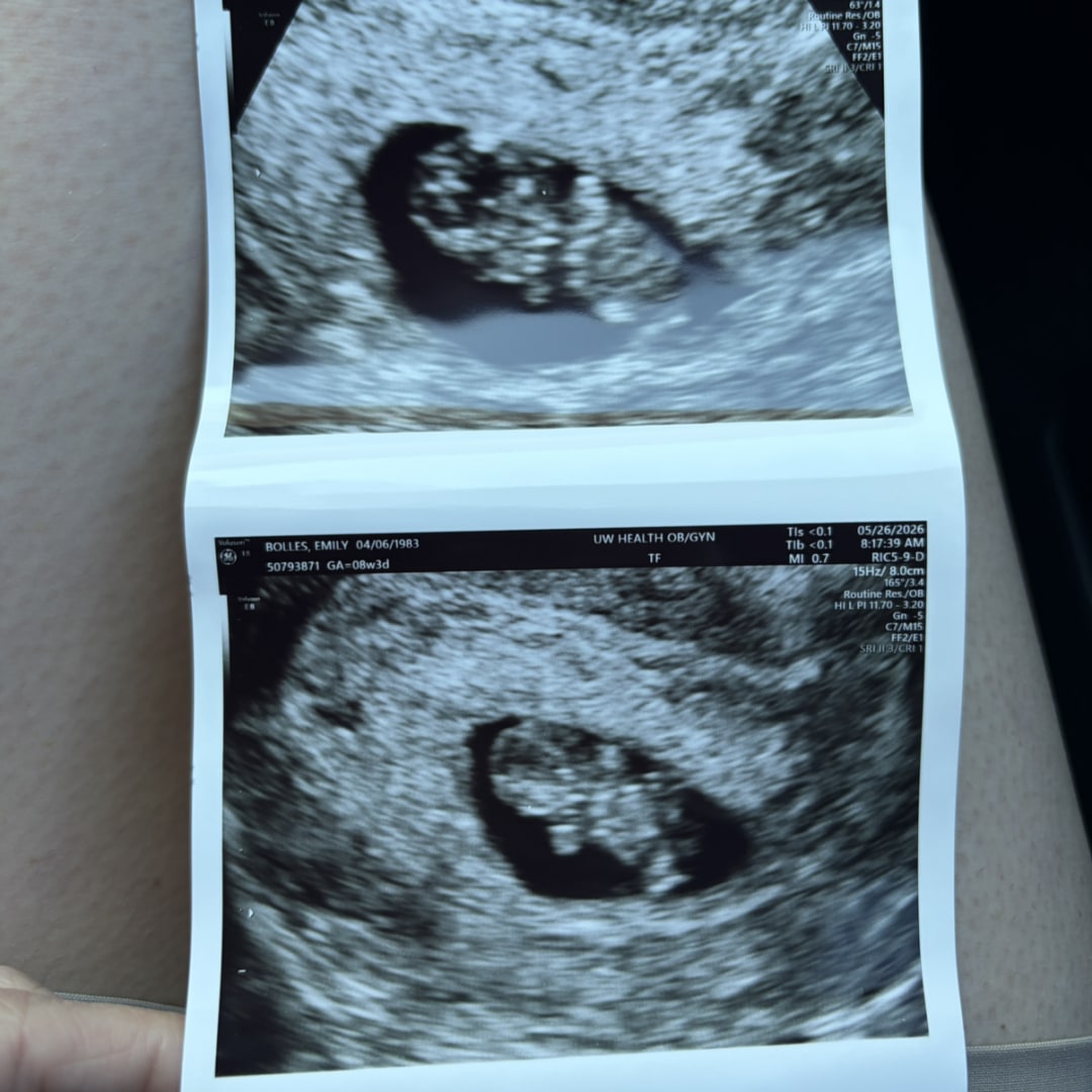 Photo shared by Emily for their Babylist baby registry.