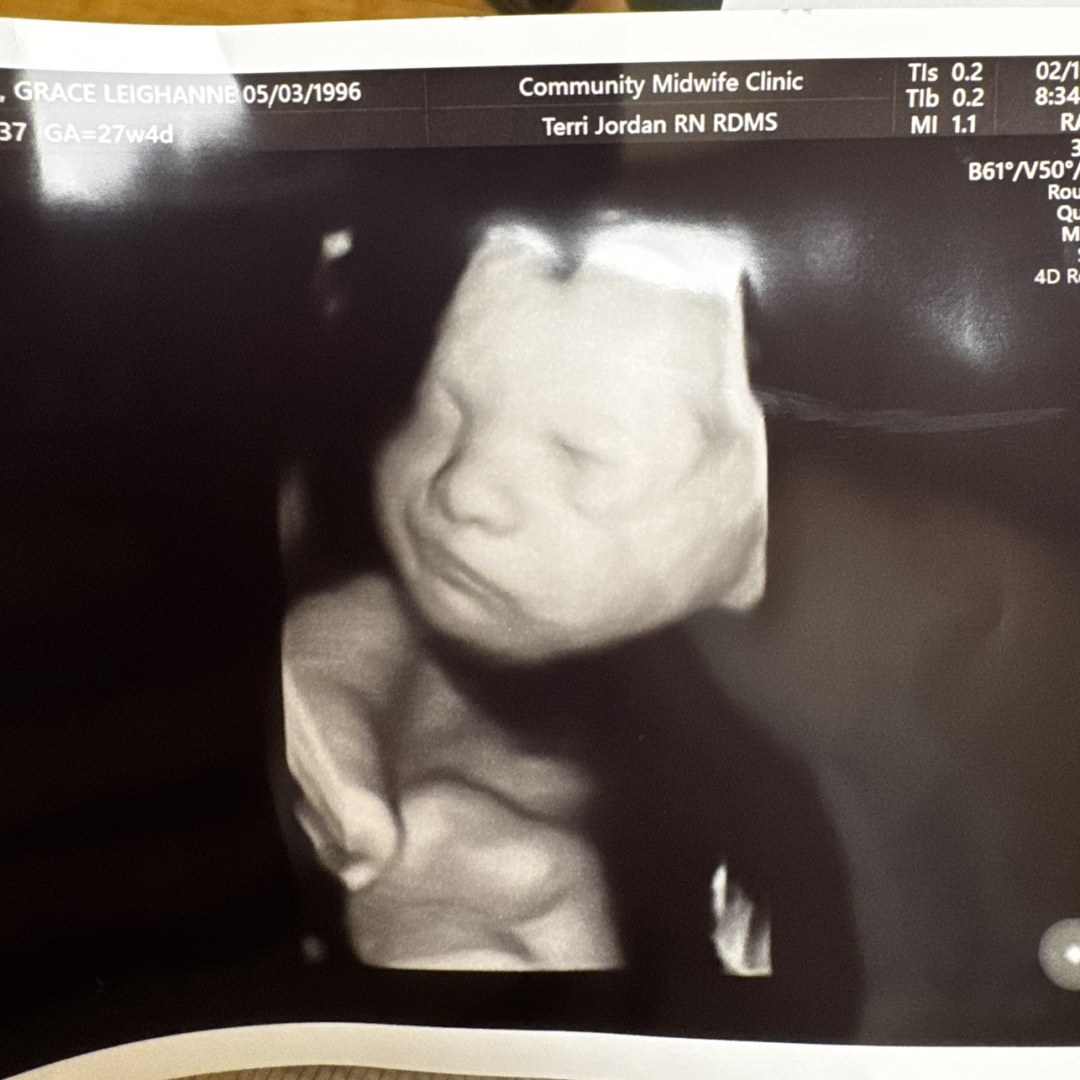 Photo shared by Grace for their Babylist baby registry.