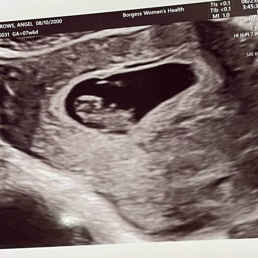 Photo shared by Angel for their Babylist baby registry.