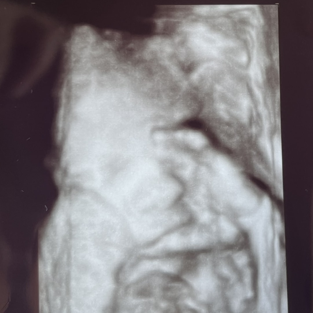 Photo shared by Madilyn for their Babylist baby registry.