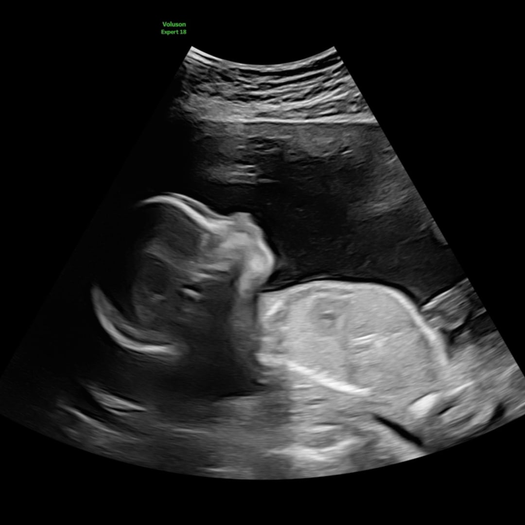 Photo shared by Carolyn for their Babylist baby registry.