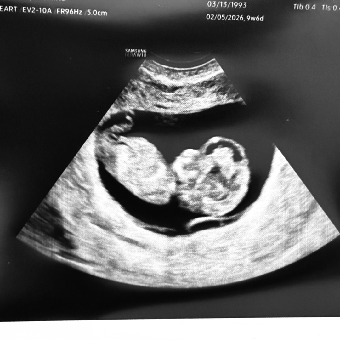 Photo shared by Jasmine for their Babylist baby registry.