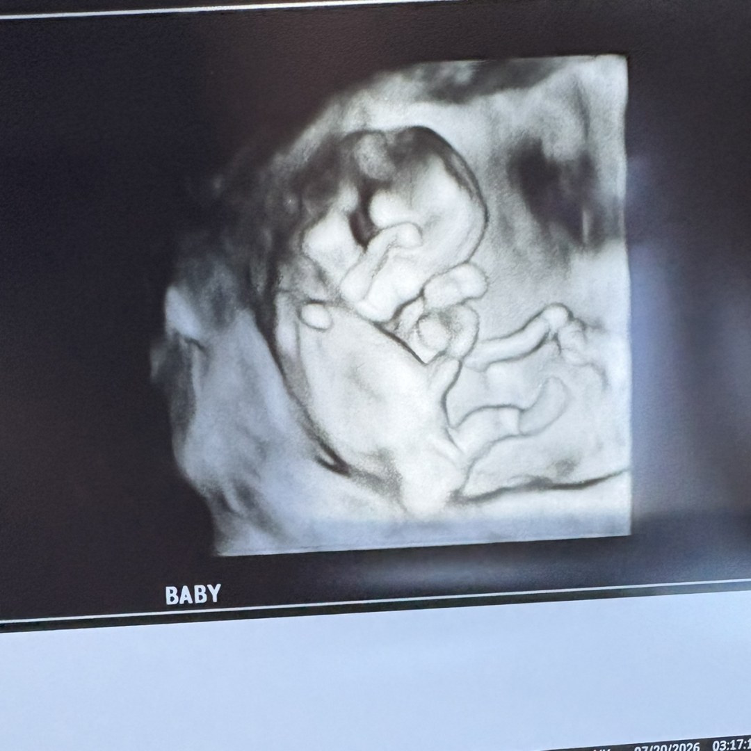 Photo shared by Aliza for their Babylist baby registry.