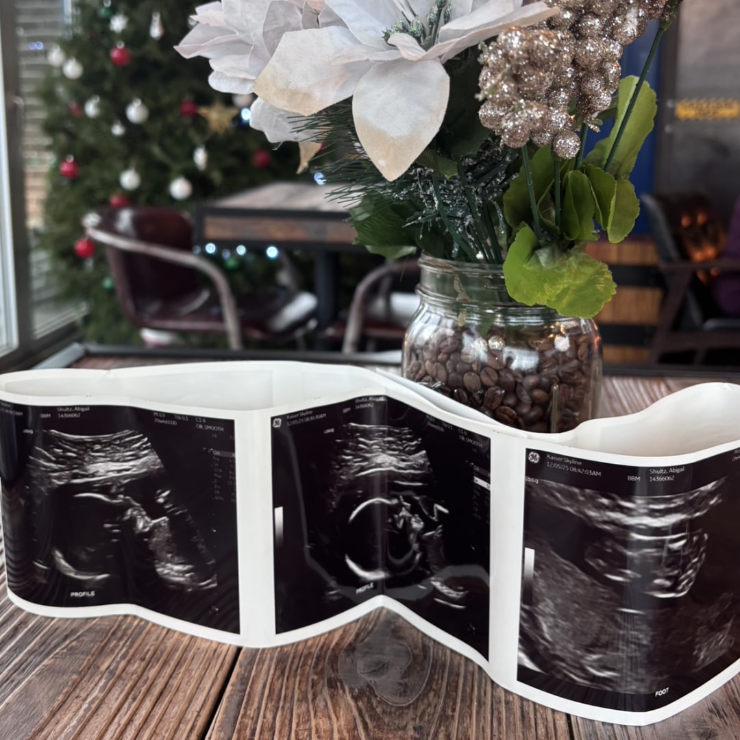 Photo shared by Abby for their Babylist baby registry.