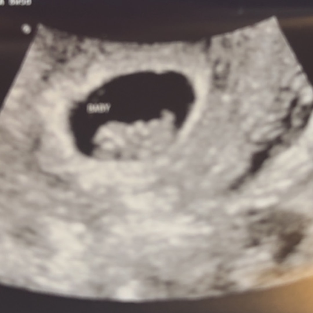 Photo shared by Janile for their Babylist baby registry.