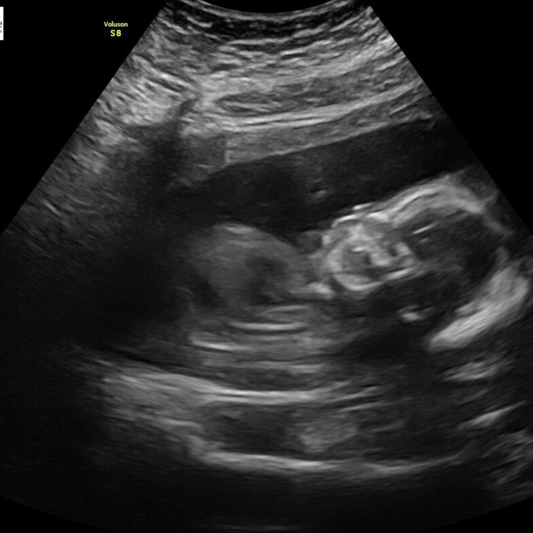 Photo shared by Unique for their Babylist baby registry.