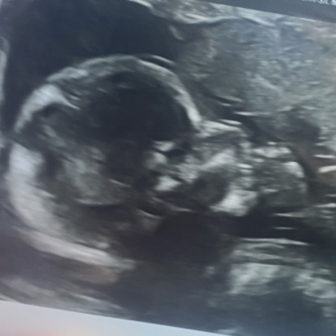 Photo shared by Garrett for their Babylist baby registry.