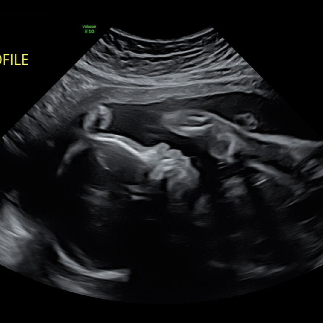 Photo shared by Kimbree for their Babylist baby registry.
