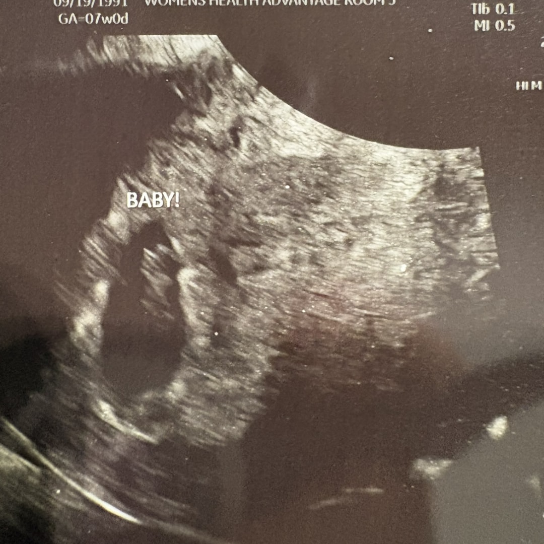 Photo shared by Dacia for their Babylist baby registry.