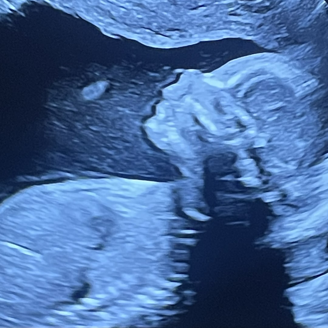 Photo shared by Alena for their Babylist baby registry.