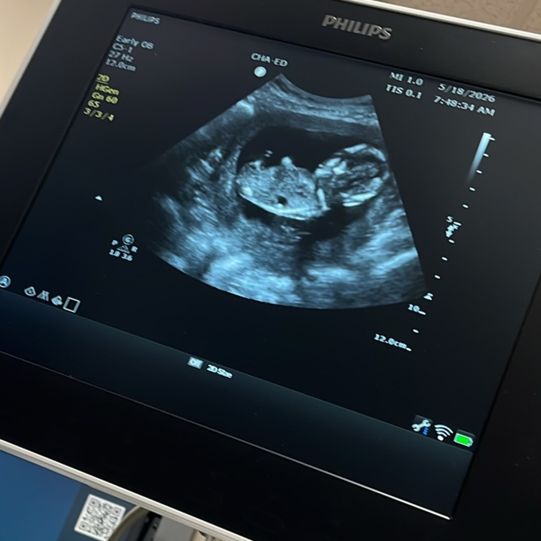 Photo shared by Rachel for their Babylist baby registry.