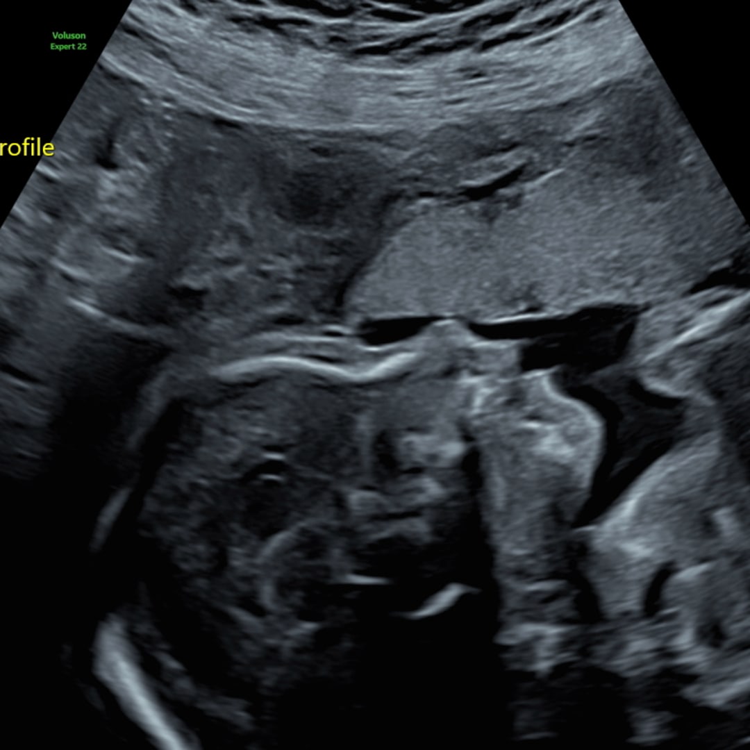 Photo shared by Samantha for their Babylist baby registry.