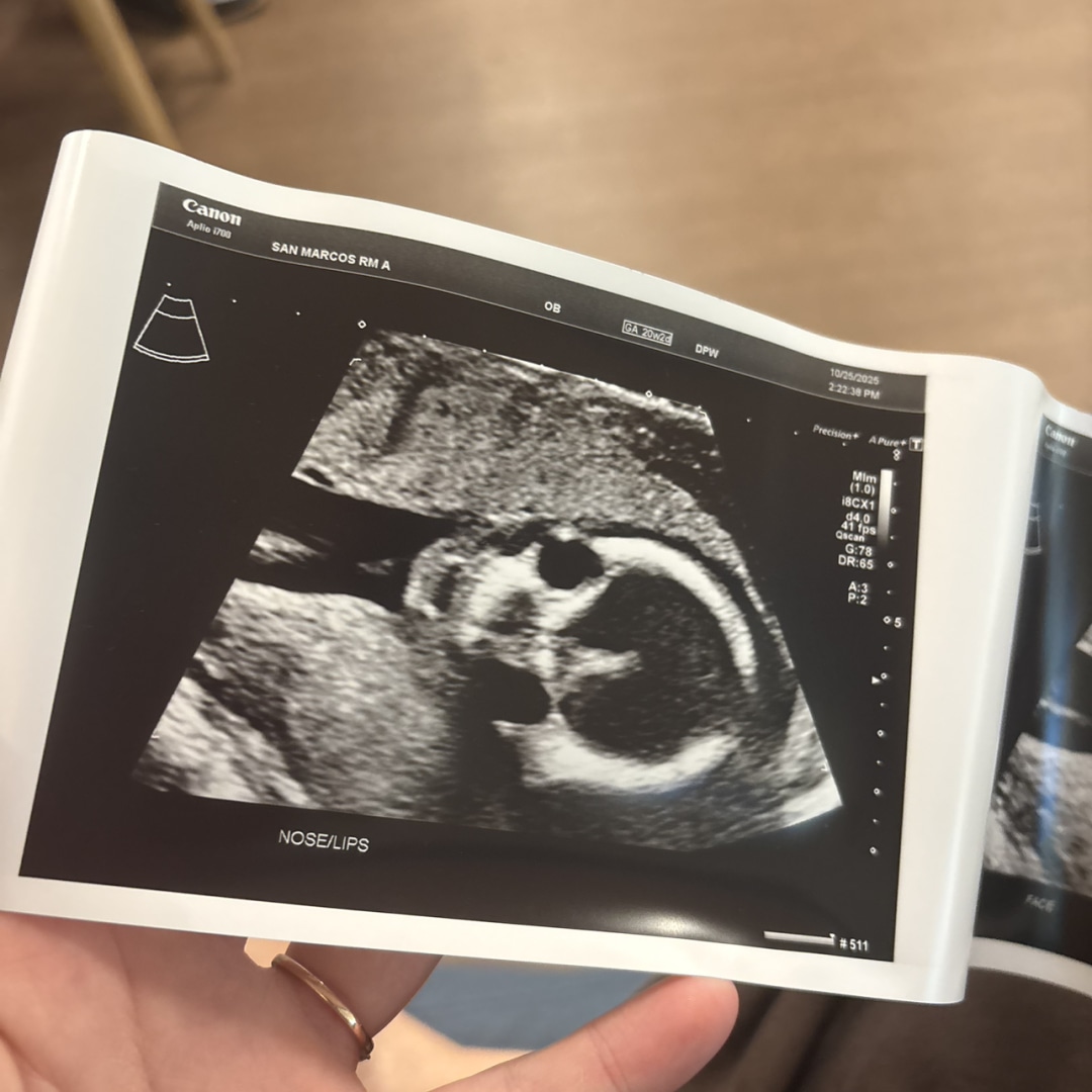 Photo shared by Becca for their Babylist baby registry.