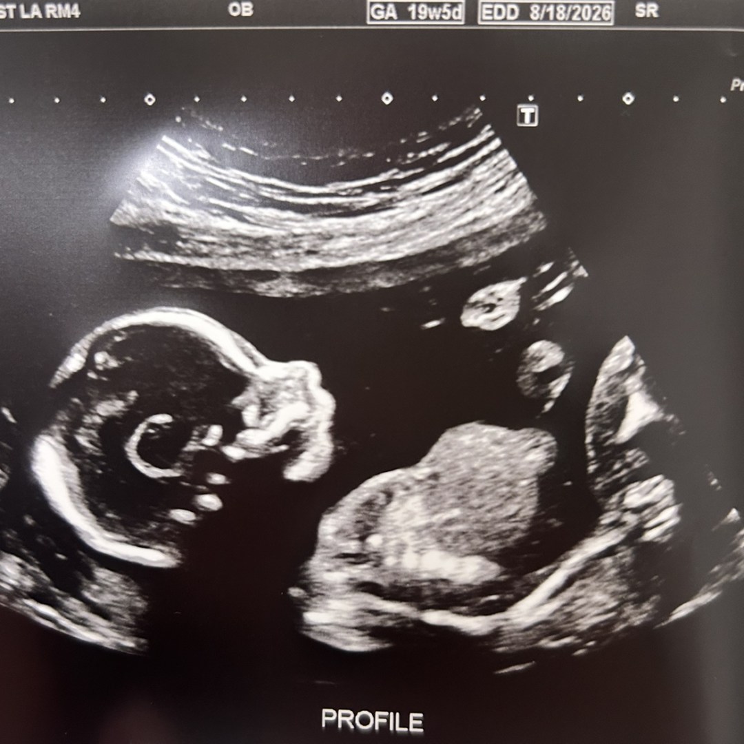 Photo shared by Donna for their Babylist baby registry.