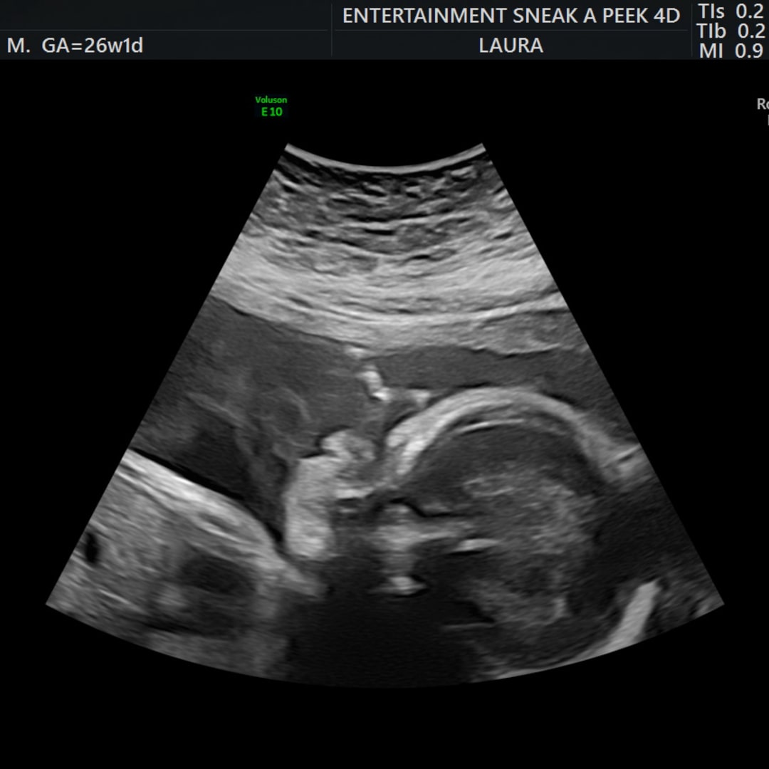 Photo shared by Jawn for their Babylist baby registry.