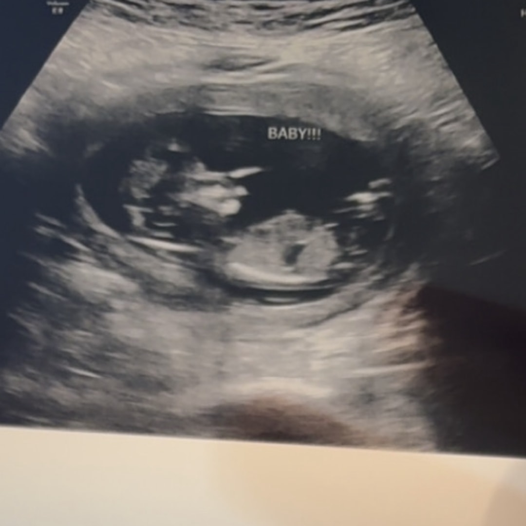 Photo shared by Lizzy for their Babylist baby registry.