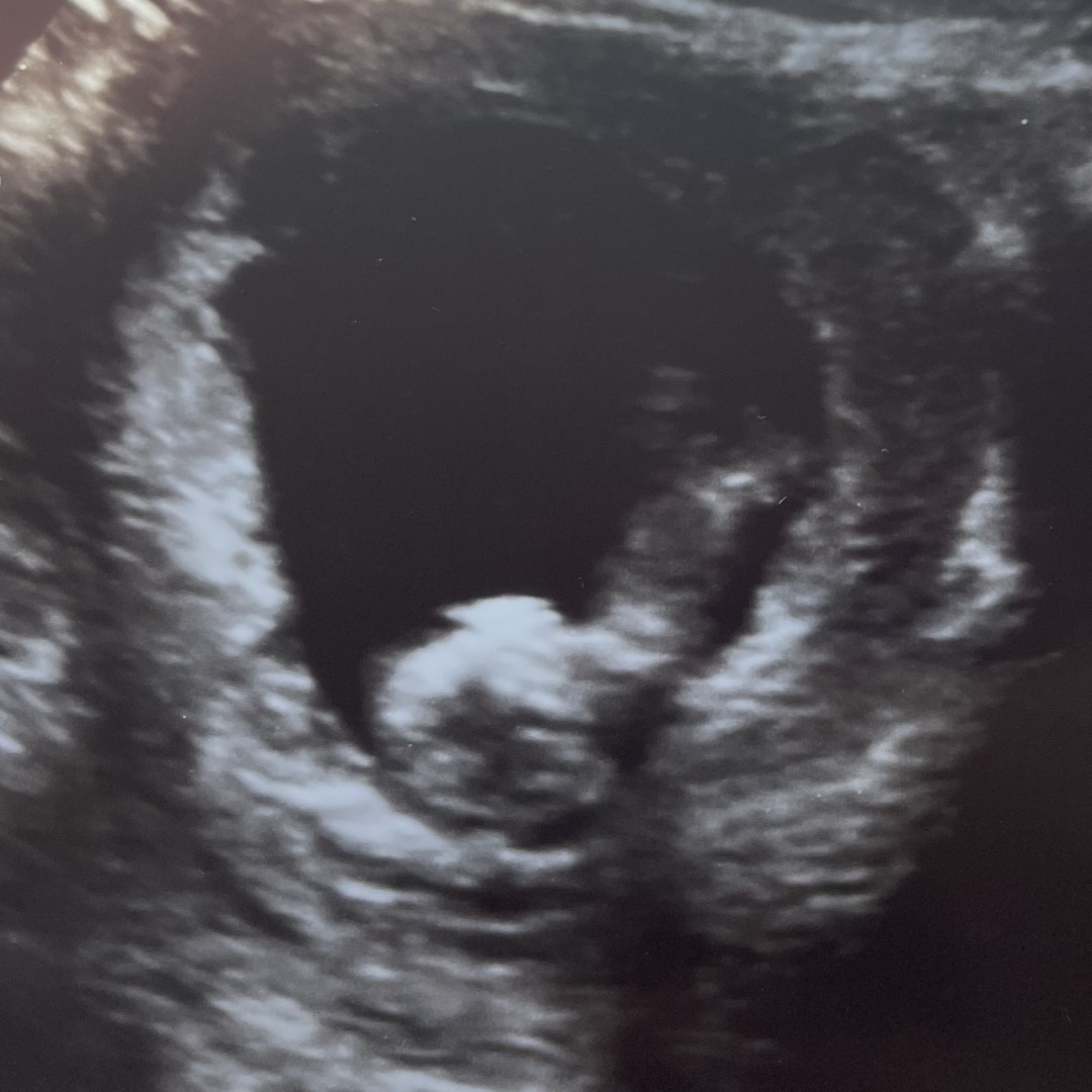 Photo shared by Alyssa for their Babylist baby registry.