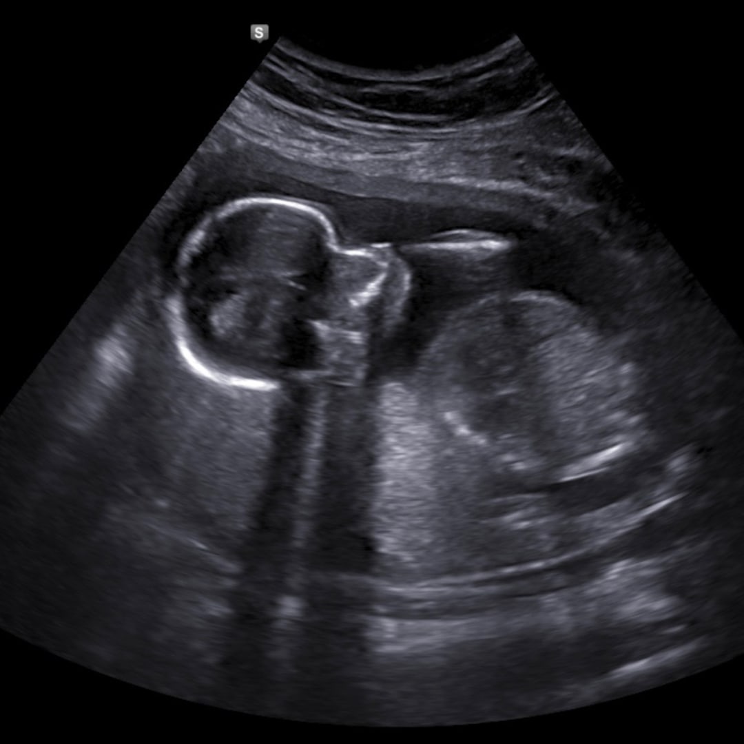 Photo shared by Fernanda for their Babylist baby registry.