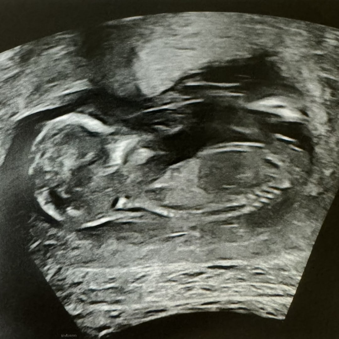 Photo shared by Ashley for their Babylist baby registry.