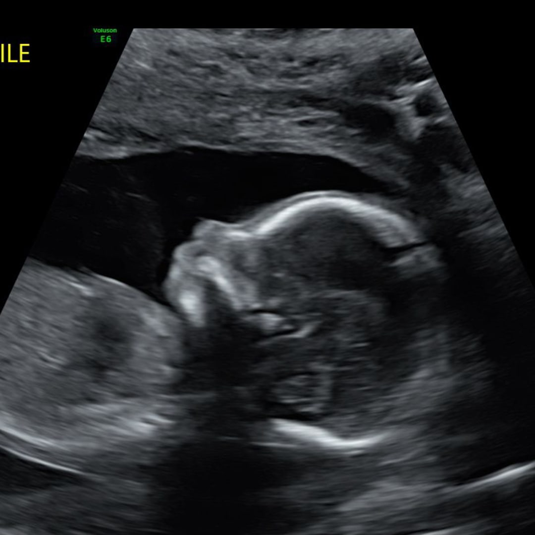 Photo shared by Jessica for their Babylist baby registry.