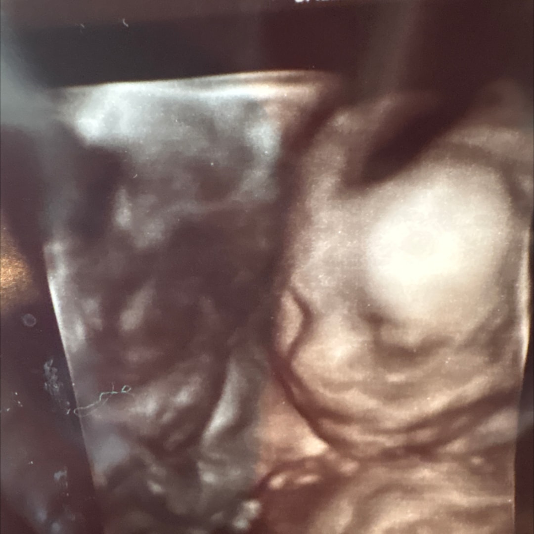 Photo shared by Kelly for their Babylist baby registry.