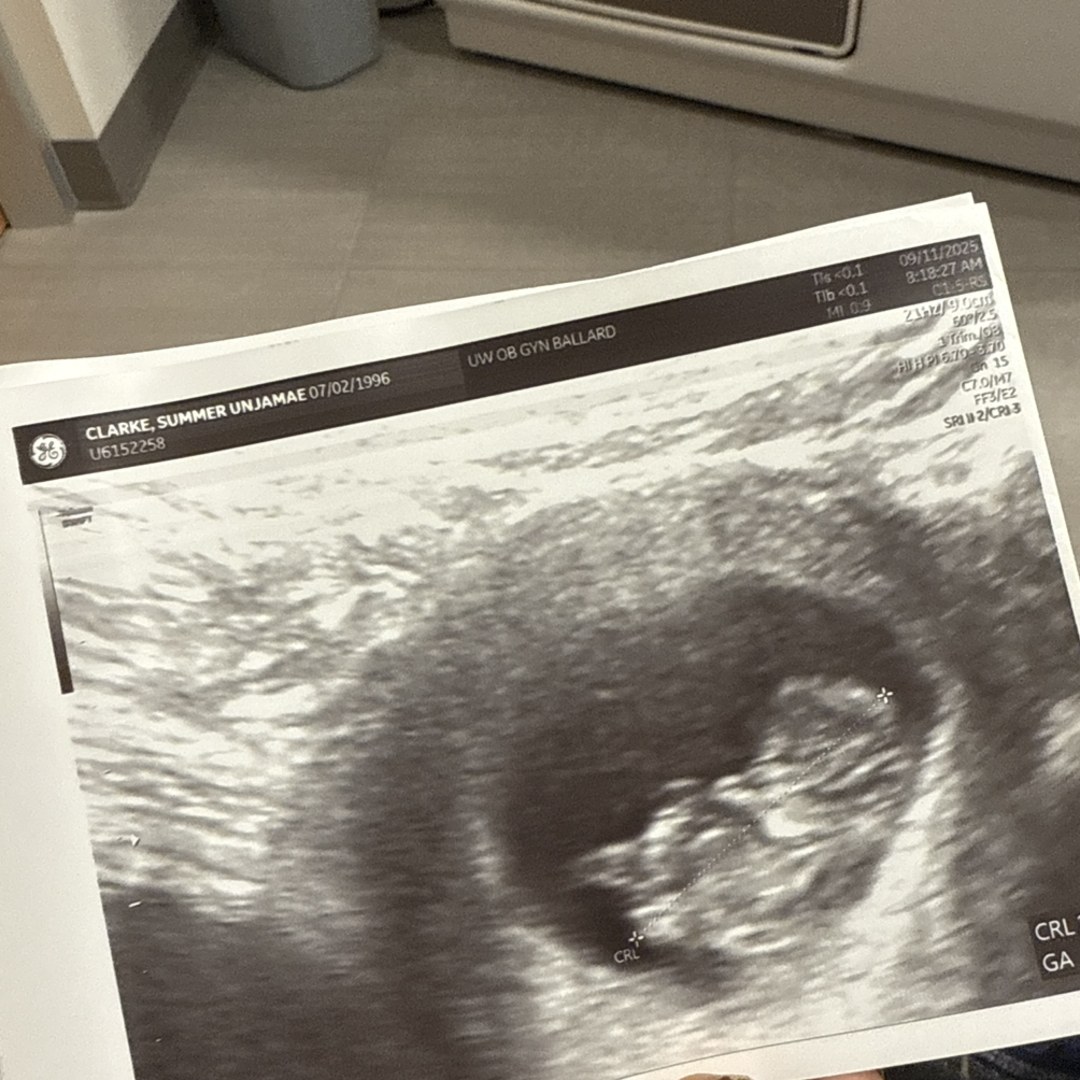 Photo shared by Summer for their Babylist baby registry.