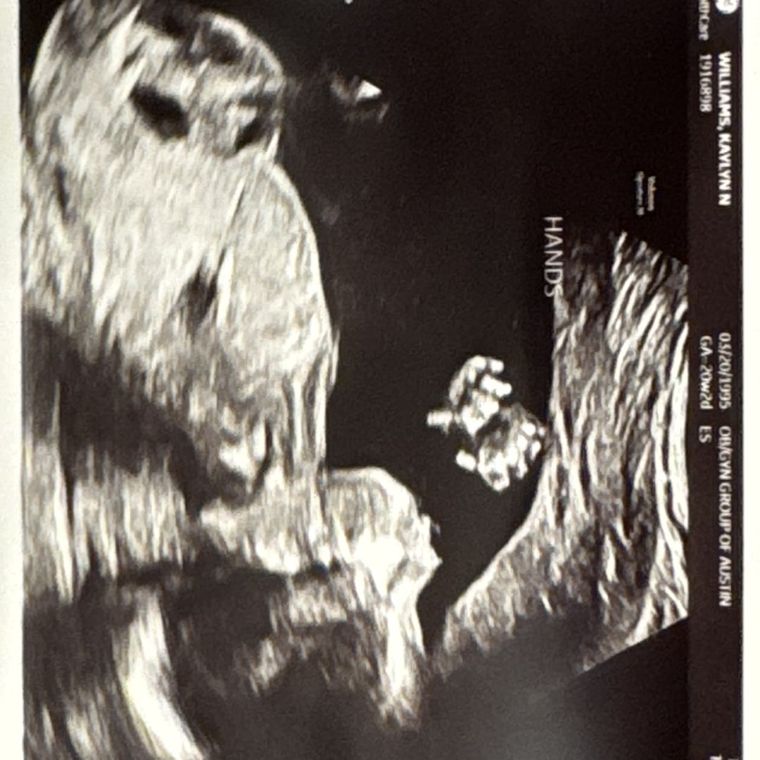 Photo shared by Kaylyn for their Babylist baby registry.